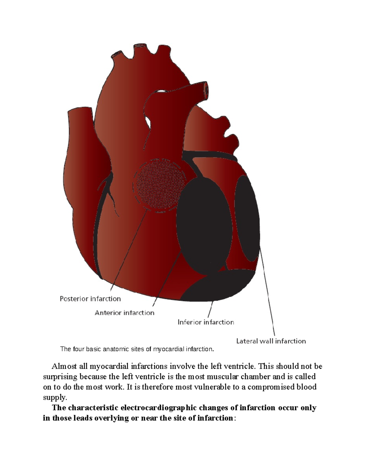 The only EKG-88 - The only EKG - The four basic anatomic sites of ...