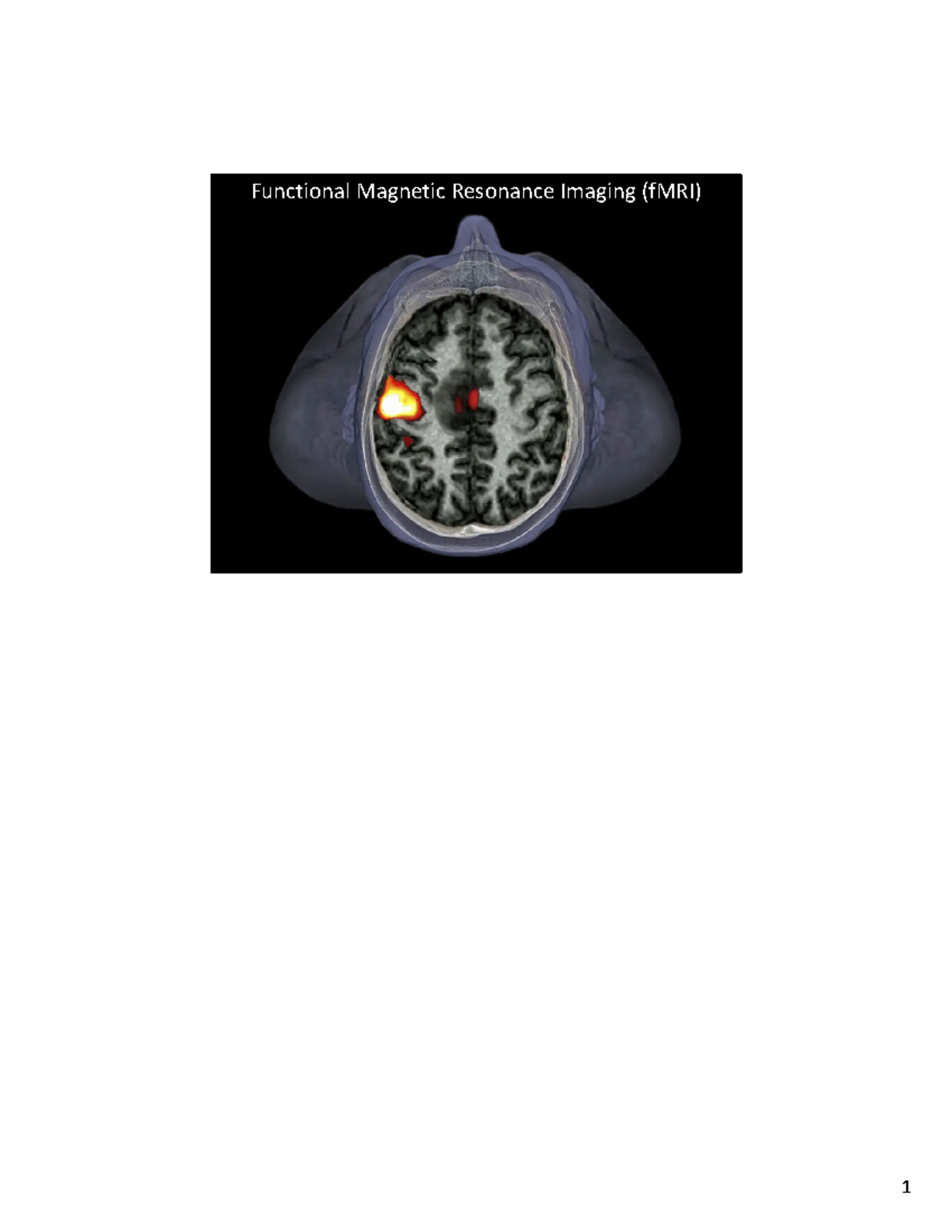 Functional Magnetic Imaging (f MRI) Lecture Notes - Functional Magnetic ...