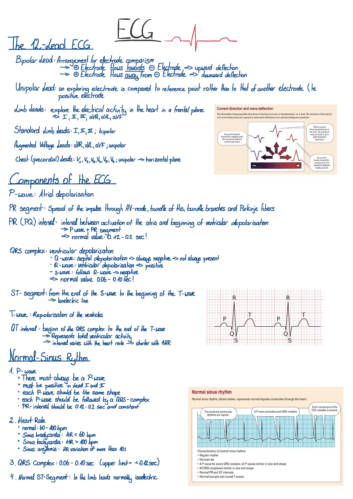 ECG short summary - The 12 - Lead ECG Bipolar Lead : Arrangement for ...