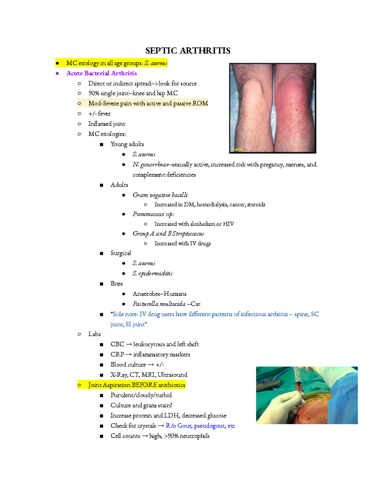 Septic Arthritis SEPTIC ARTHRITIS MC etiology in all age groups S