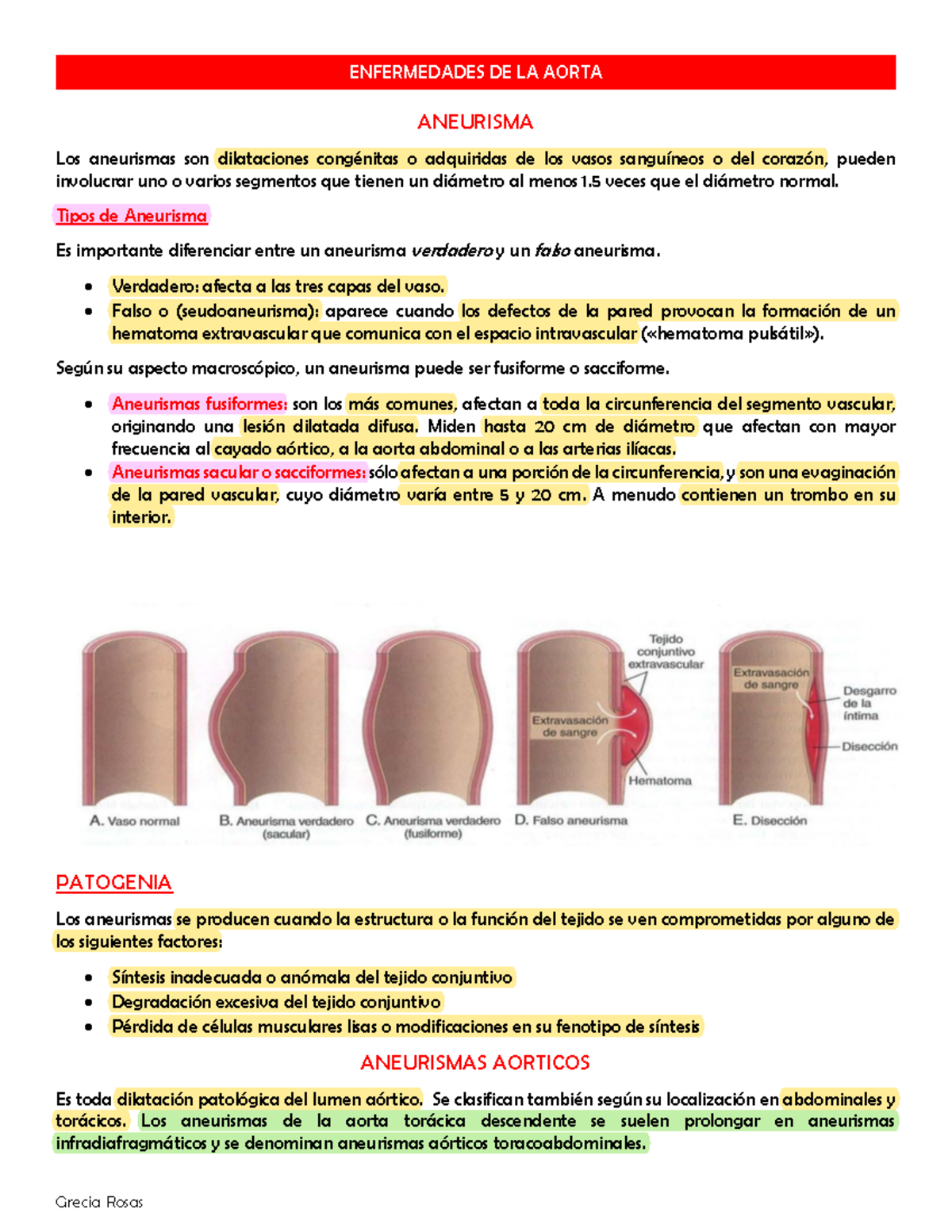 7. Enfermedades DE LA Aorta - ANEURISMA Los aneurismas son dilataciones ...