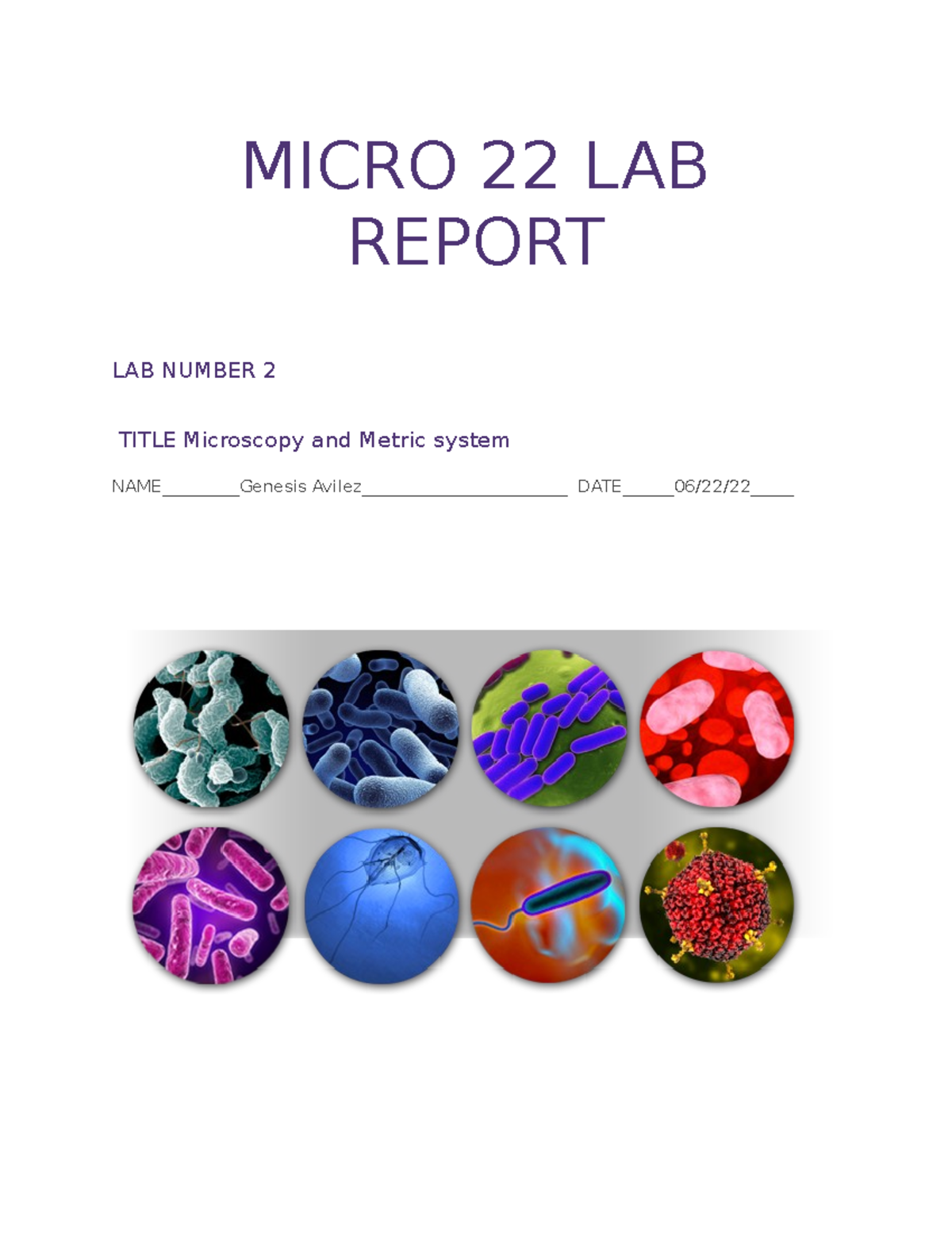 Micro 22 lab report 2 MICRO 22 LAB REPORT LAB NUMBER 2 TITLE