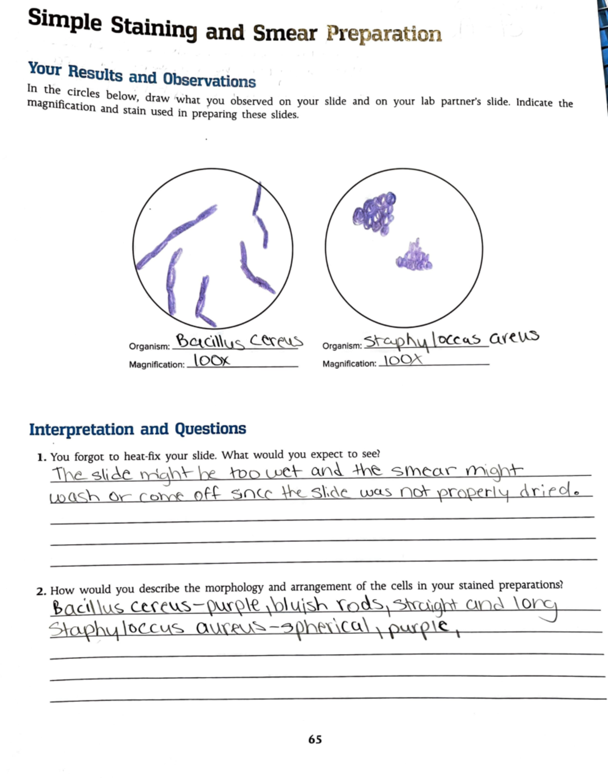 Staining Lab laboratory results Simple Staining and Smear