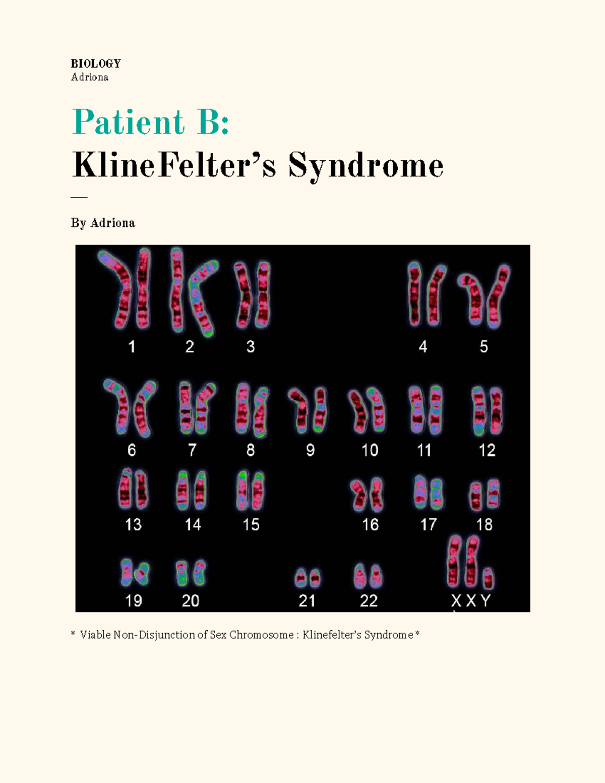 Writing Assignment Patient B Karyotype-2 - BIOL K101 - IUPUI - Studocu