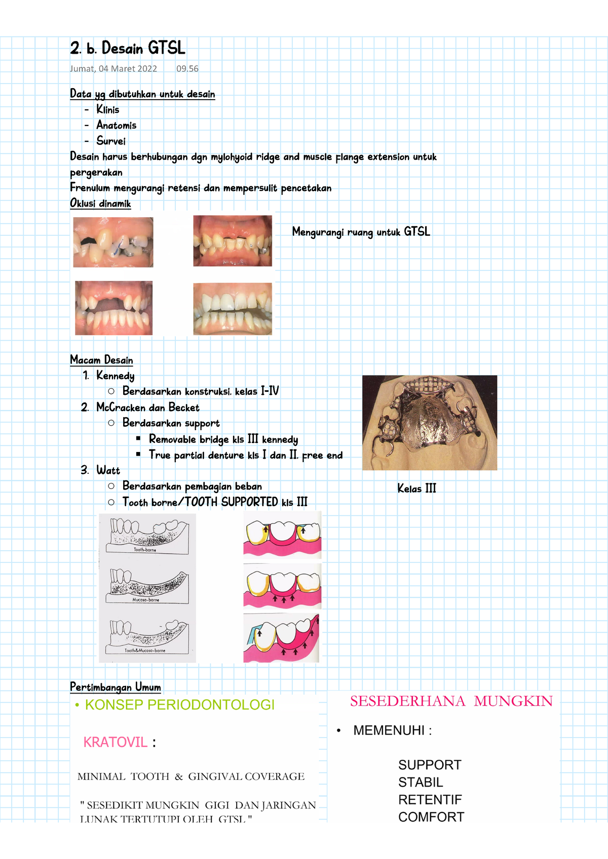 Prostodonsia II - 2. B. Desain GTSL - Data Yg Dibutuhkan Untuk Desain ...