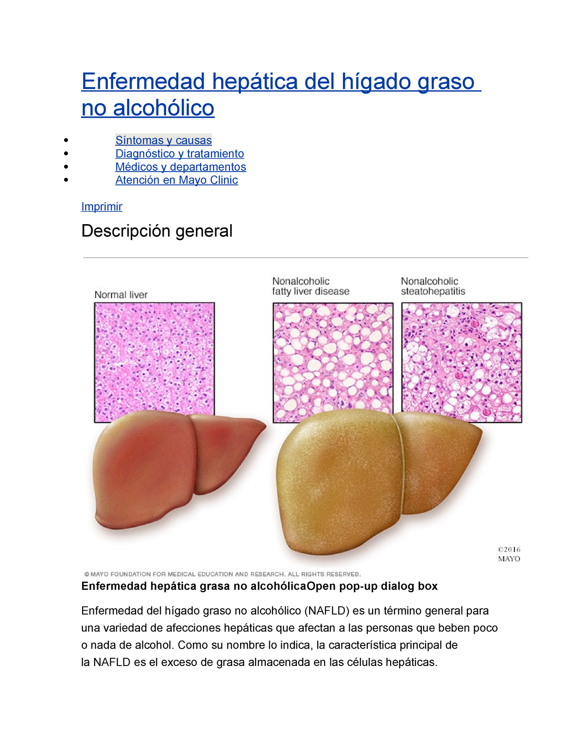 Higado Graso Enfermedad Hepática Del Hígado Graso No Alcohólico Síntomas Y Causas Diagnóstico 2372