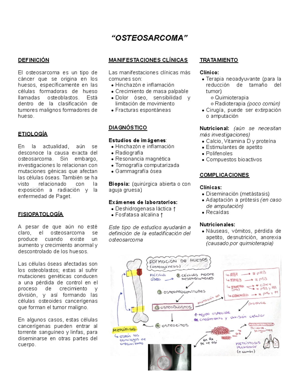 Osteosarcoma - Está dentro de la clasificación de tumores malignos ...