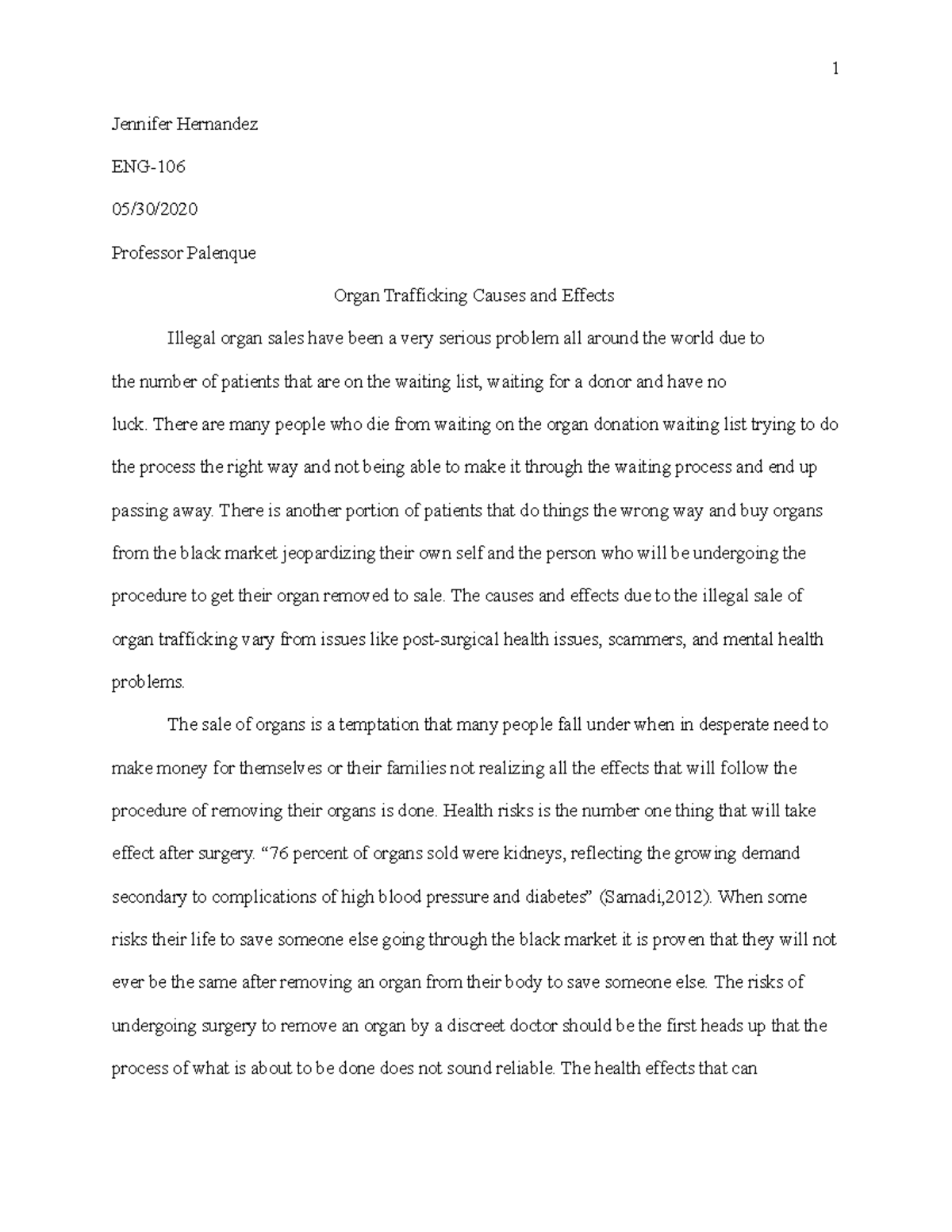 Causes of organ trafficking image