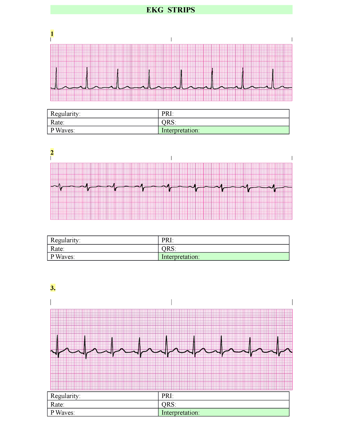 EKG Strips Nursing 329 CD 2018 1 st set - EKG STRIPS 1 Regularity: PRI ...