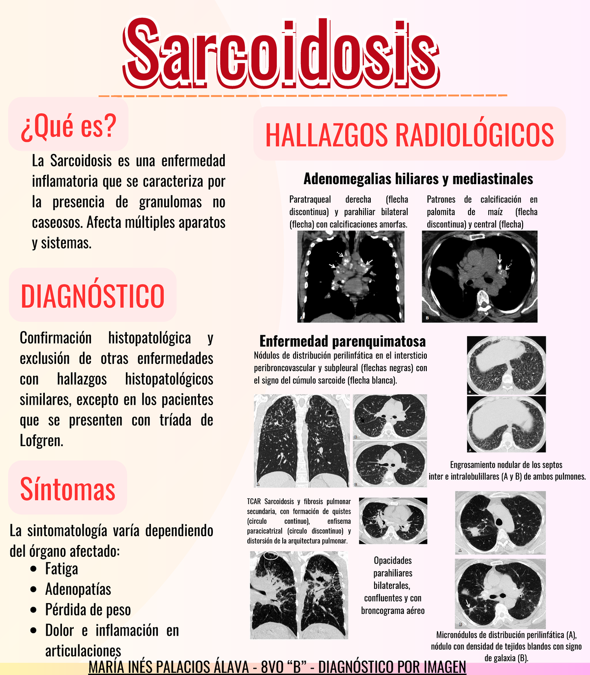 Sarcoidosis - Resumen diagnostico por imagen - SarcoidosisSarcoidosis ...