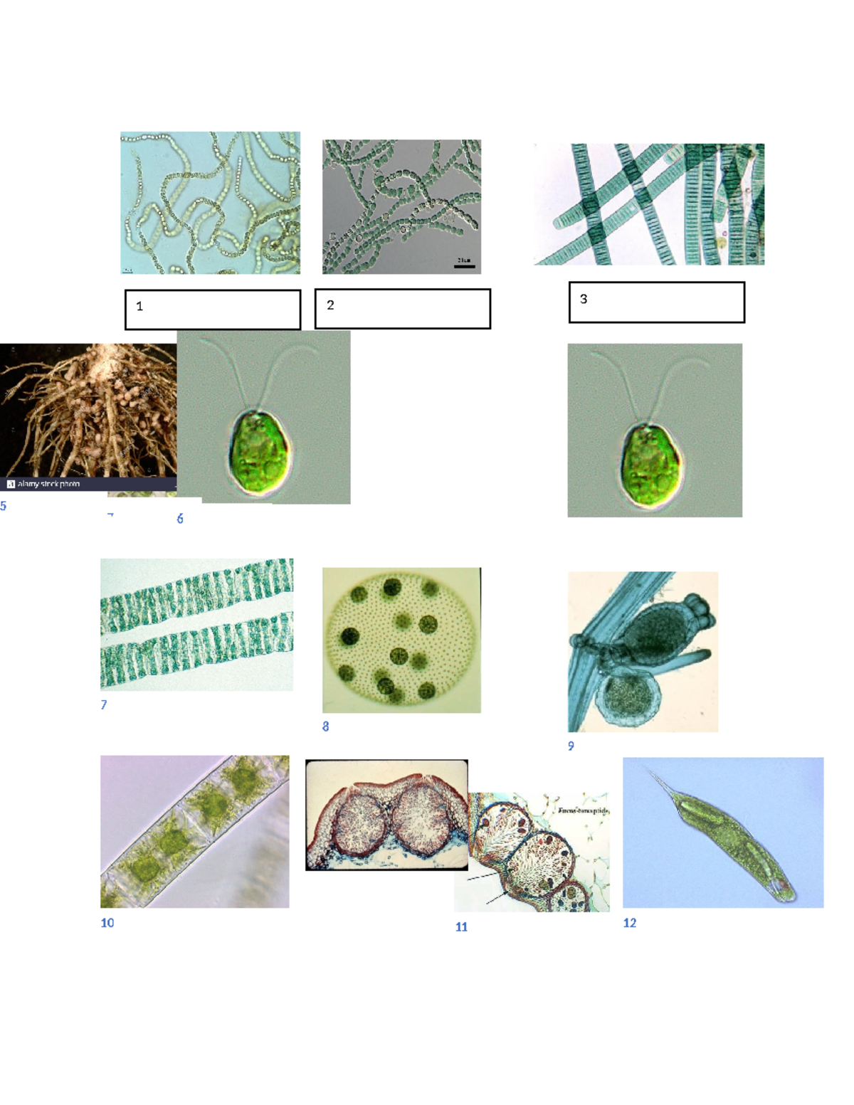 BIO 2 LAB Midterm Practice 14 20 35 Saccharomyces Morchella Claviceps Lichen thallus