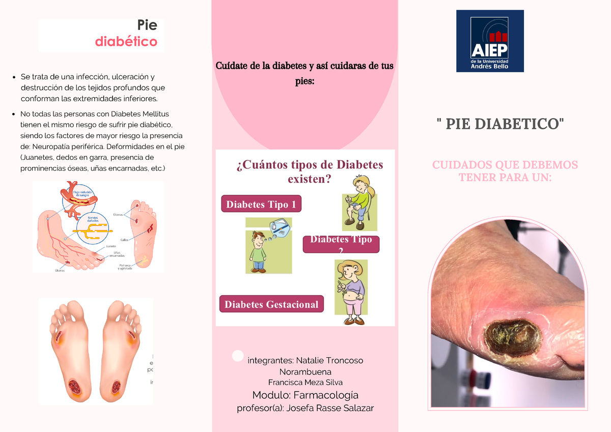 TRIPTICO Pie Diabetico Editar PDF Diabetes Pie, 45% OFF