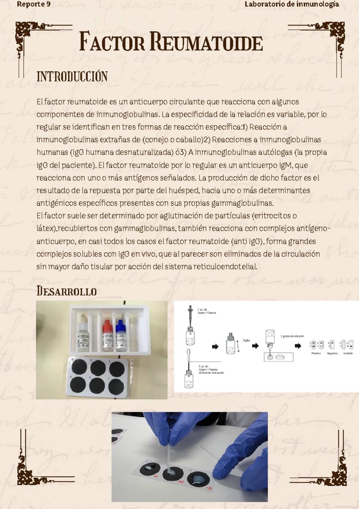 Reporte 9 Factor reumatoide - Factor Reumatoide El factor reumatoide es ...