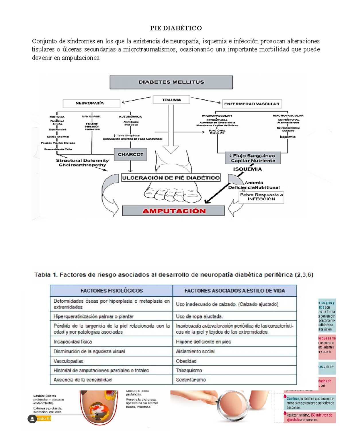 Resumen Pie Diabético PIE DIABÉTICO Conjunto de síndromes en los que