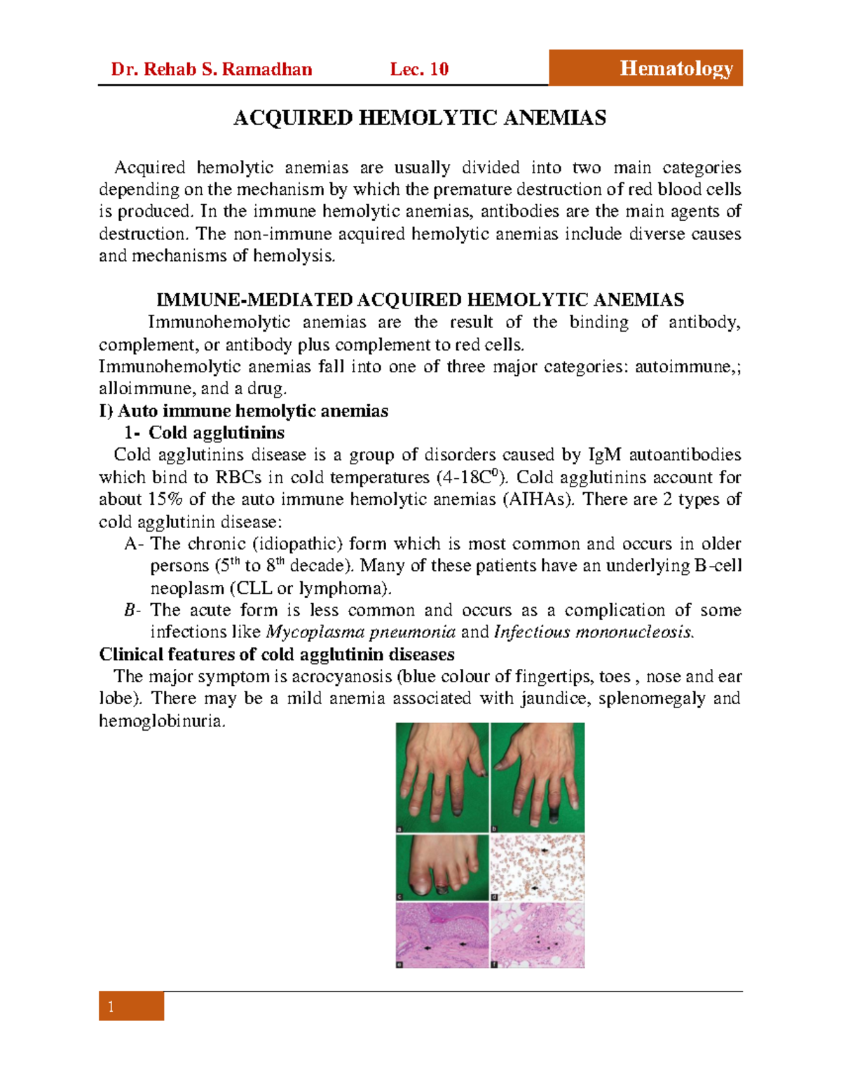 Acquired Hemolytic Anemias - ACQUIRED HEMOLYTIC ANEMIAS Acquired ...