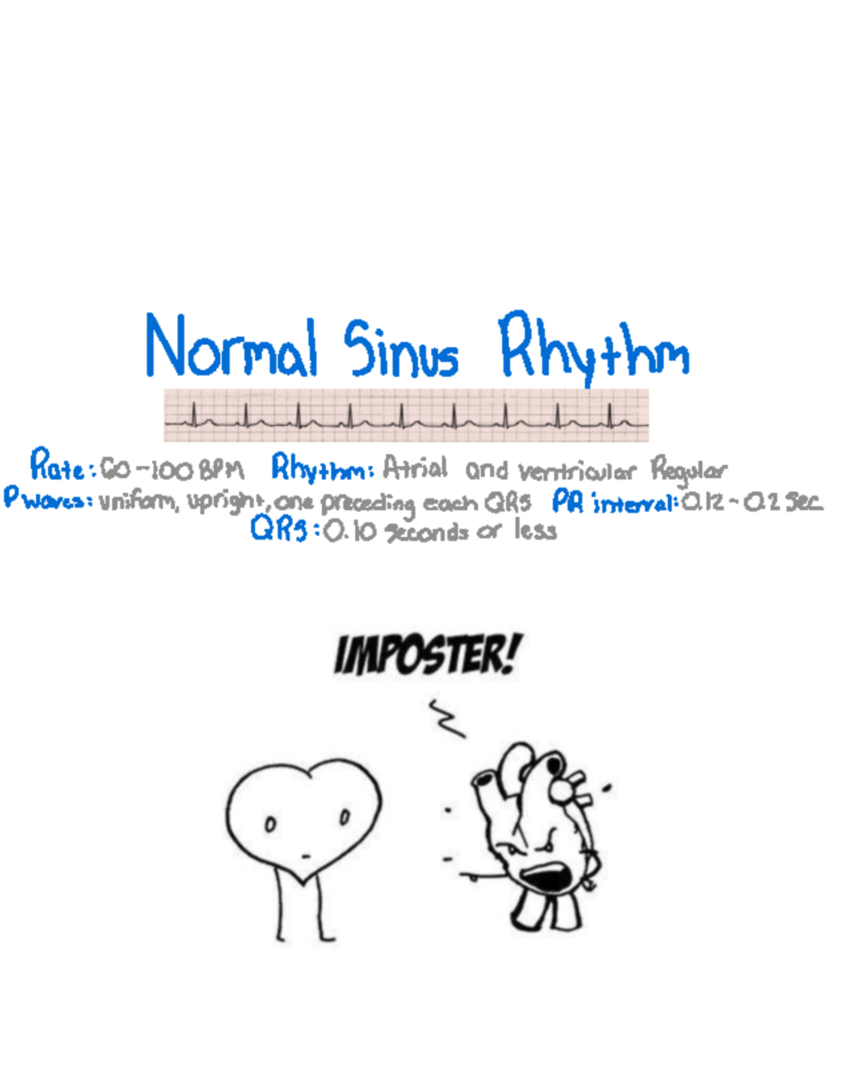Rhythm And Dysthymia - normal Sinus Rhythm Rate : Go -100 BPM Rhythm ...