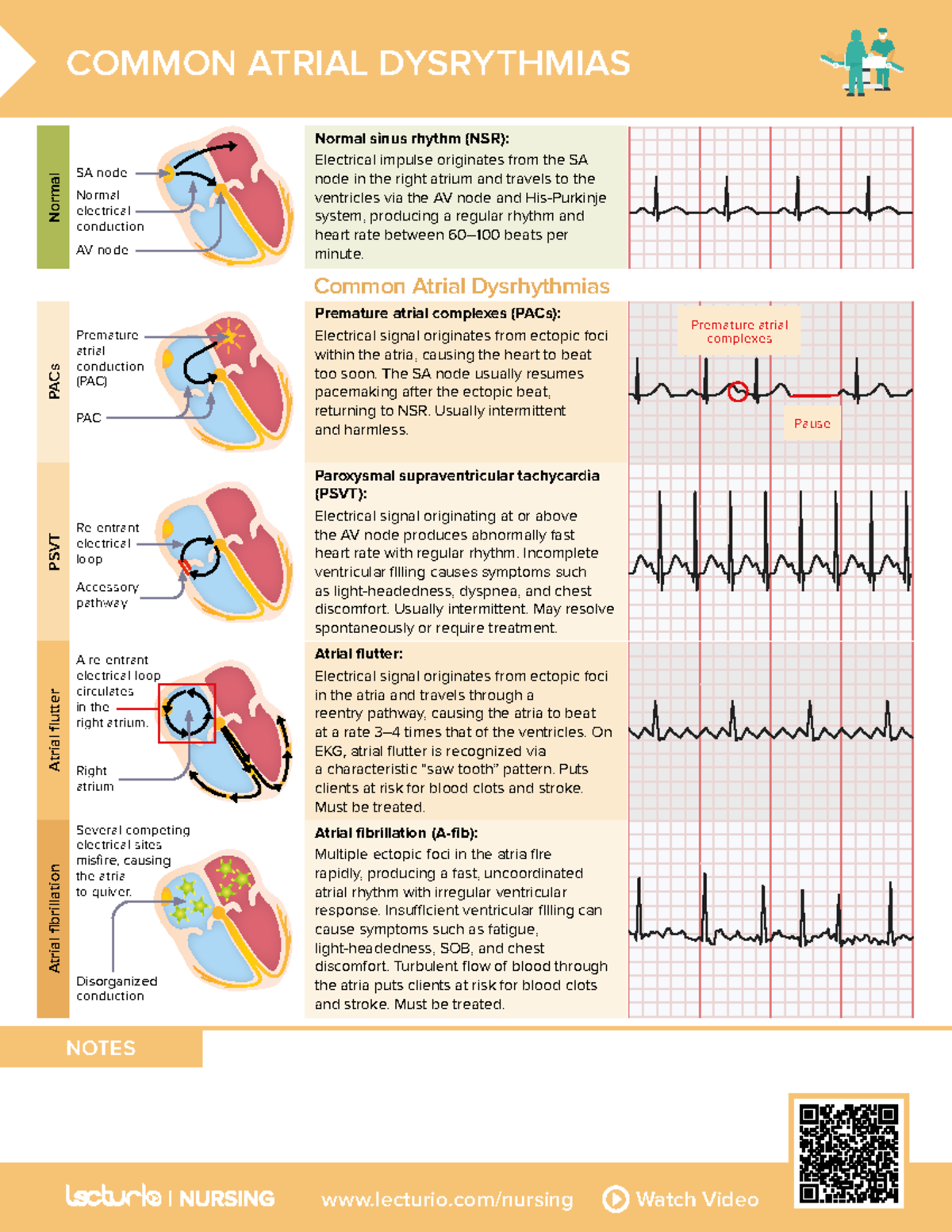 Nursing Concept Maps - NOTES COMMON ATRIAL DYSRYTHMIAS Common Atrial ...