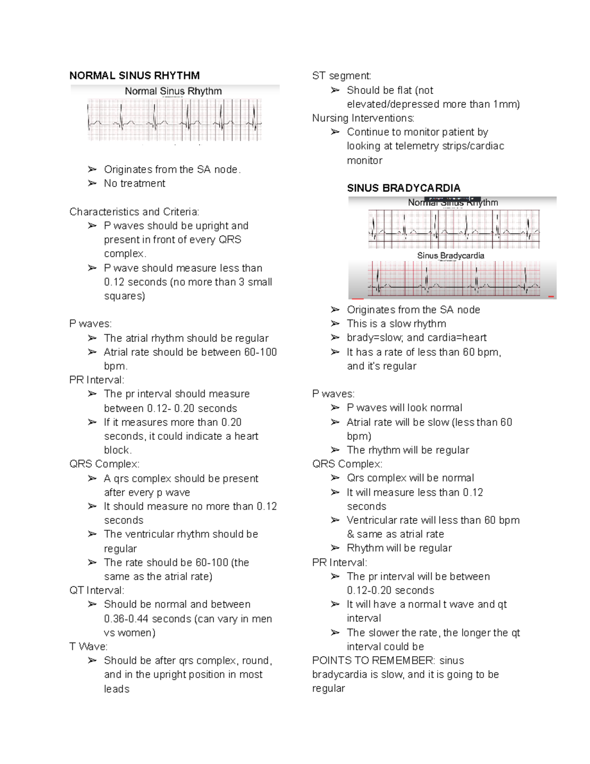 ECG Rhythm - NORMAL SINUS RHYTHM Originates from the SA node. No ...