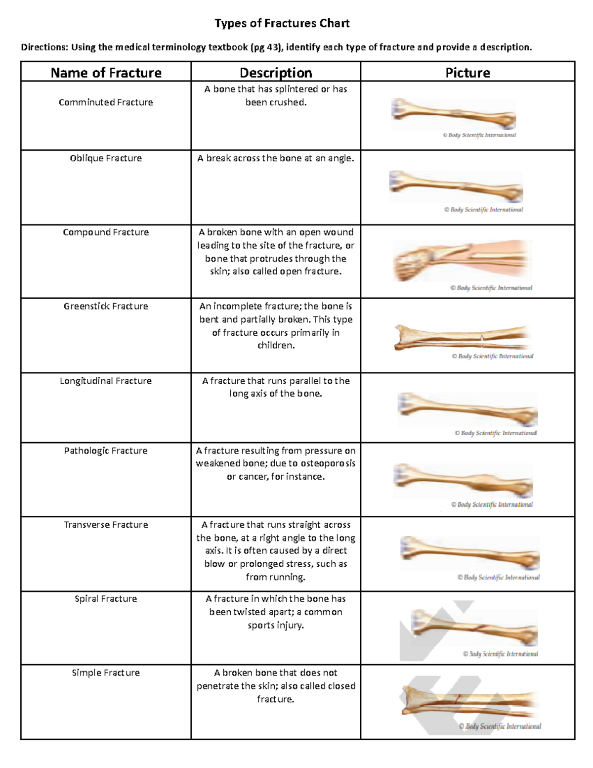 Types of Fractures Chart - Types of Fractures Chart Directions: Using ...
