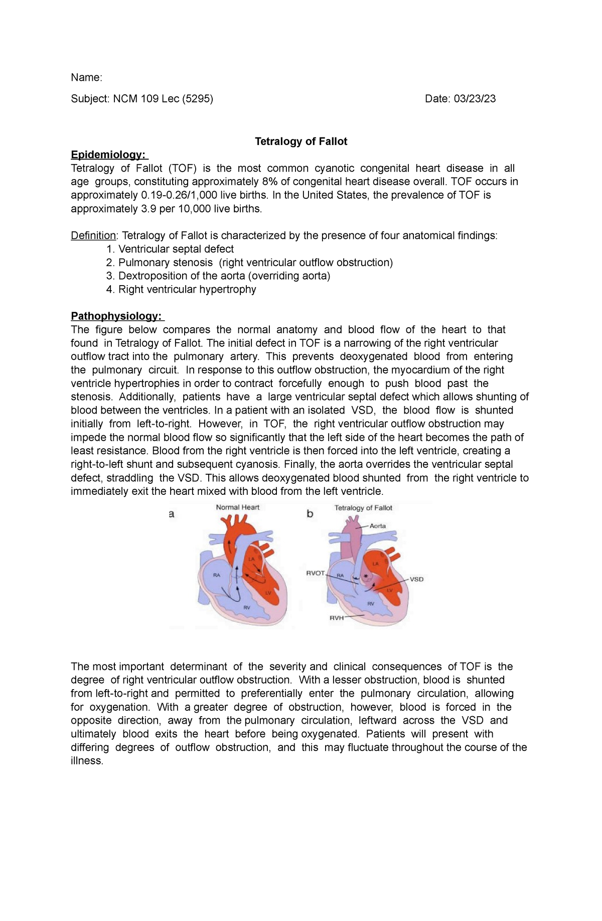 Tetralogy of fallot - Contains its epidemiology, pathophysiology ...