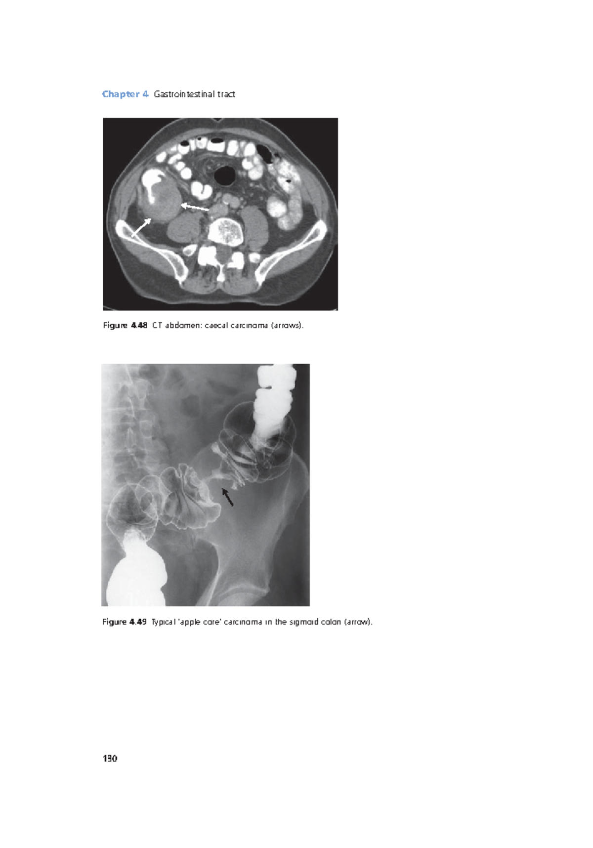 Radiology Lecture Notes pdf (44) Chapter 4 Gastrointestinal tract 130