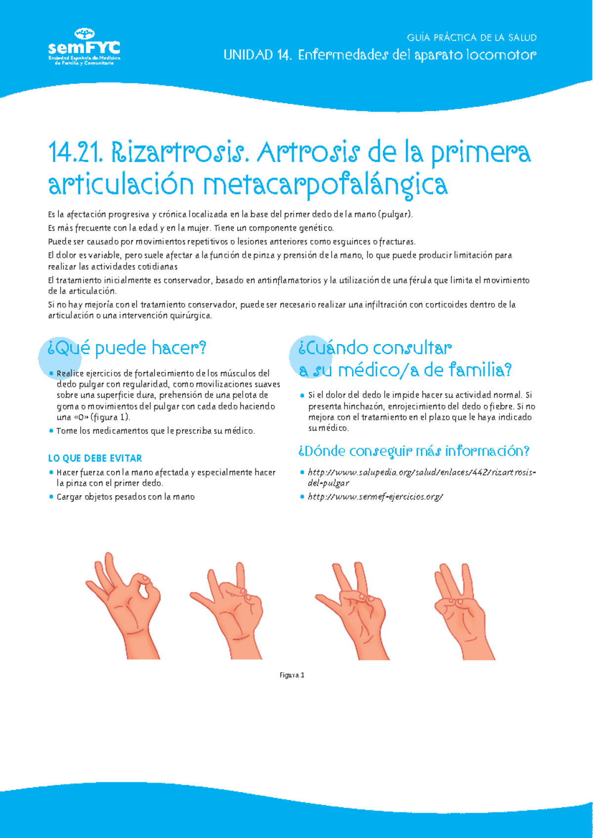 Rizartrosis - GUÍA PRÁCTICA DE LA SALUD UNIDAD 14. Enfermedades del ...