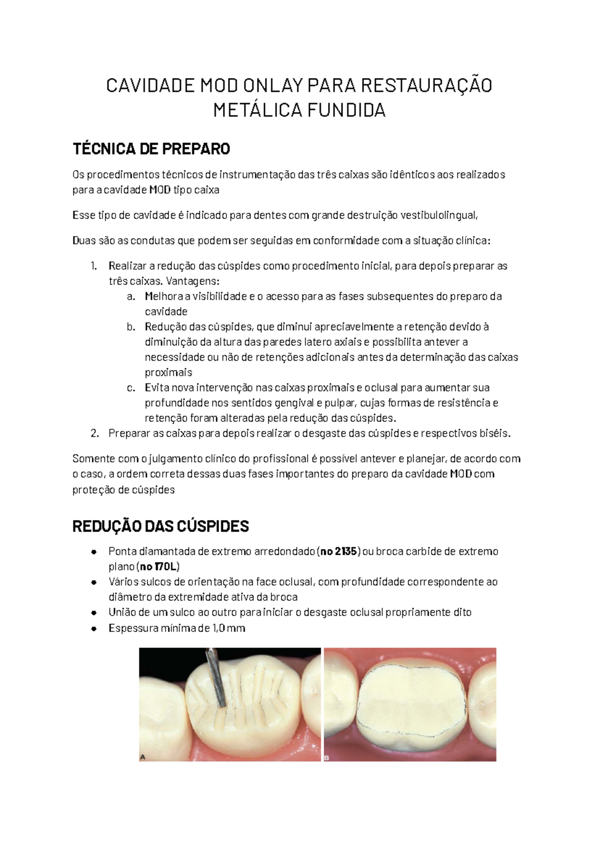 8. Preparo Onlay - CAVIDADE MOD ONLAY PARA RESTAURAÇÃO METÁLICA FUNDIDA ...