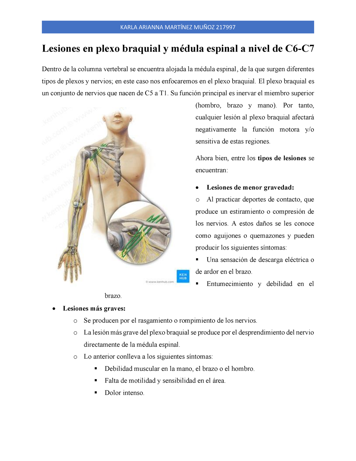 Lesiones En Plexo Braquial A Nivel De C6 - Lesiones En Plexo Braquial Y ...