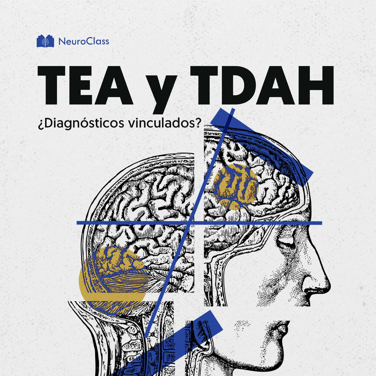 TEA Y TDAH Superposici N De Diagn Sticos 1695446784 - Superposición De ...