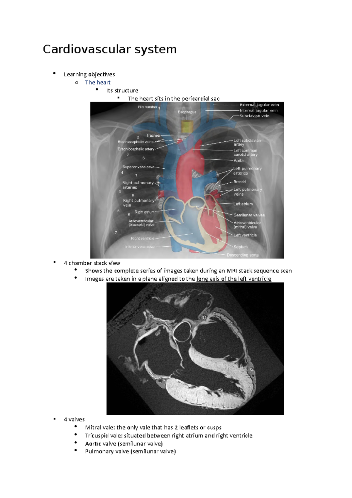 Cardiovascular system pericardial sac A doublewalled sac containing