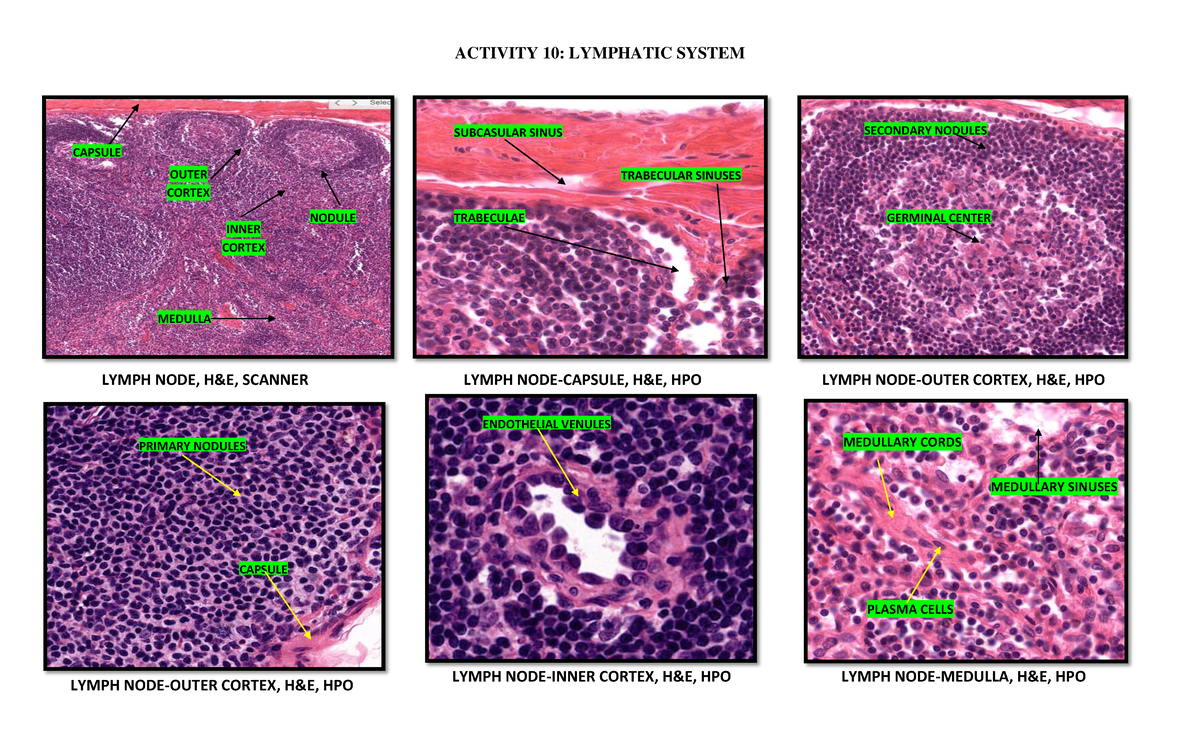 Histopathology Lymphatic System ACTIVITY 10 LYMPHATIC SYSTEM