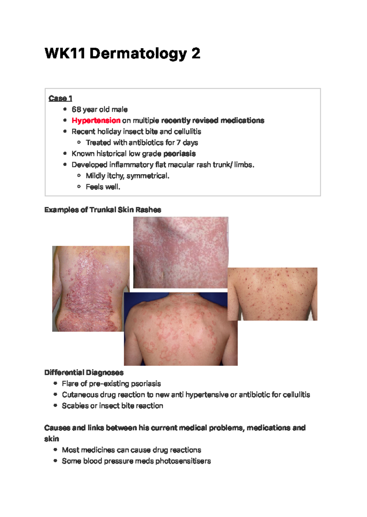 WK11 Dermatology 2 W K1 1 D e r m a to l o g y 2 Examples of Trunkal