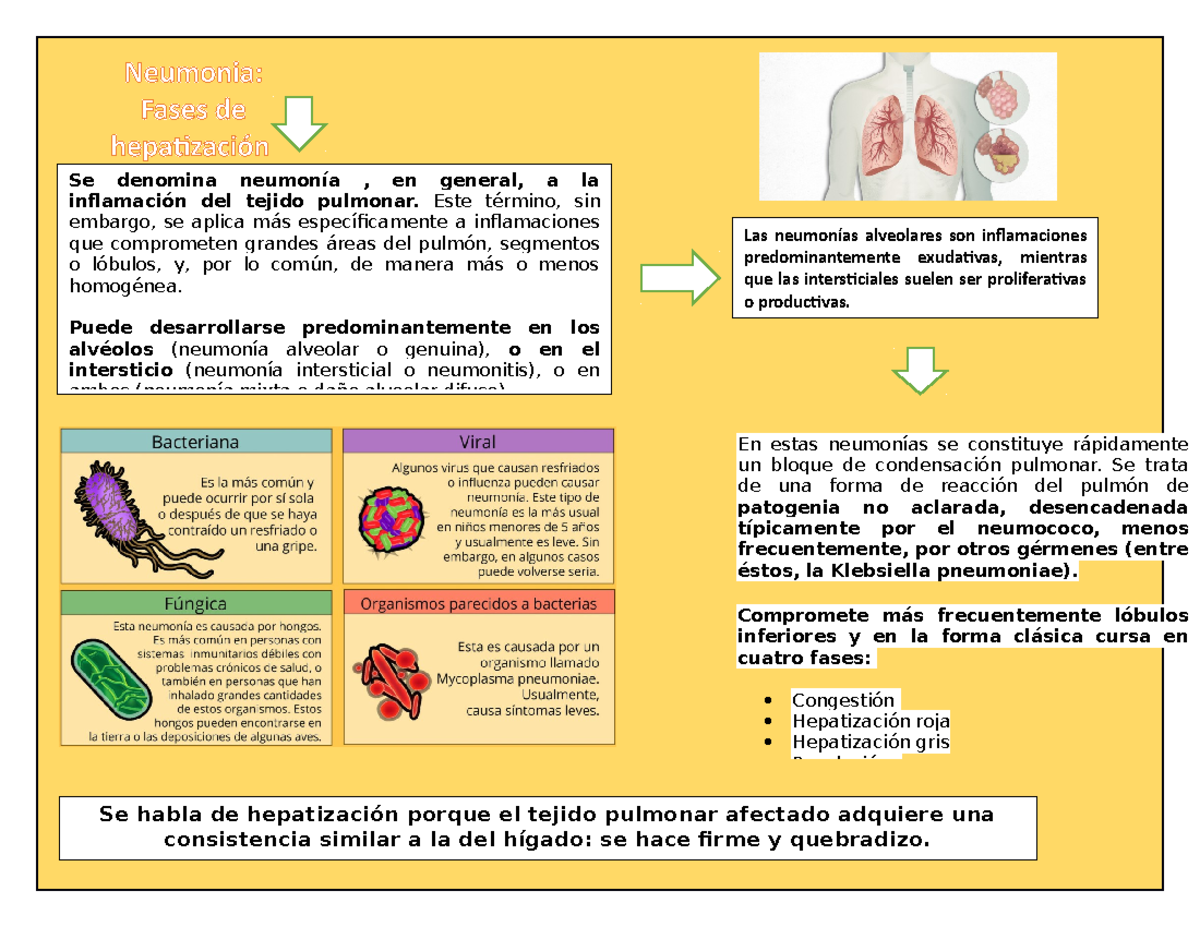 etapas de la neumonia lobar