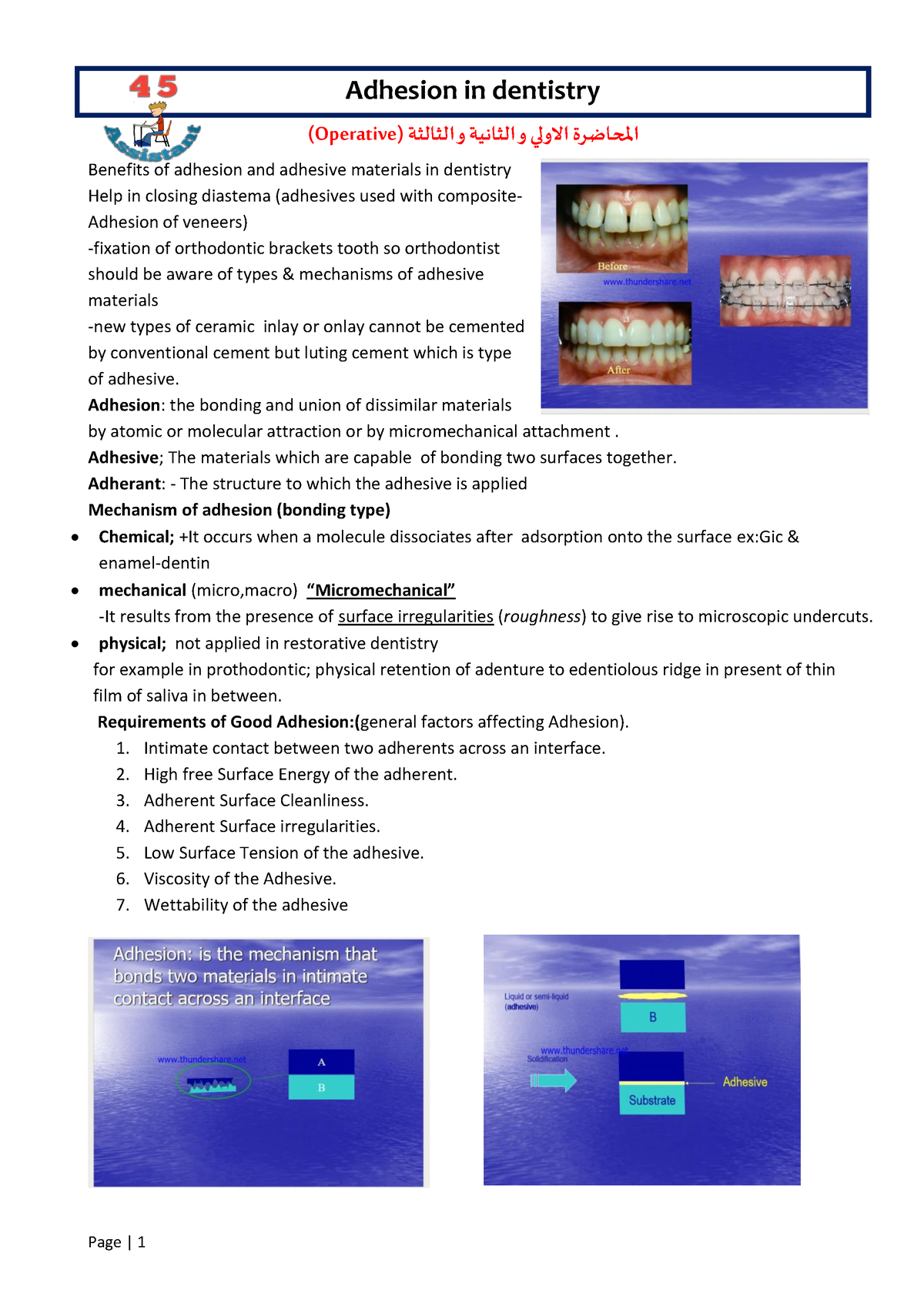 01- 02- 03- Adhesion In Dentistry - Adhesion In Dentistry )Operative(و ...