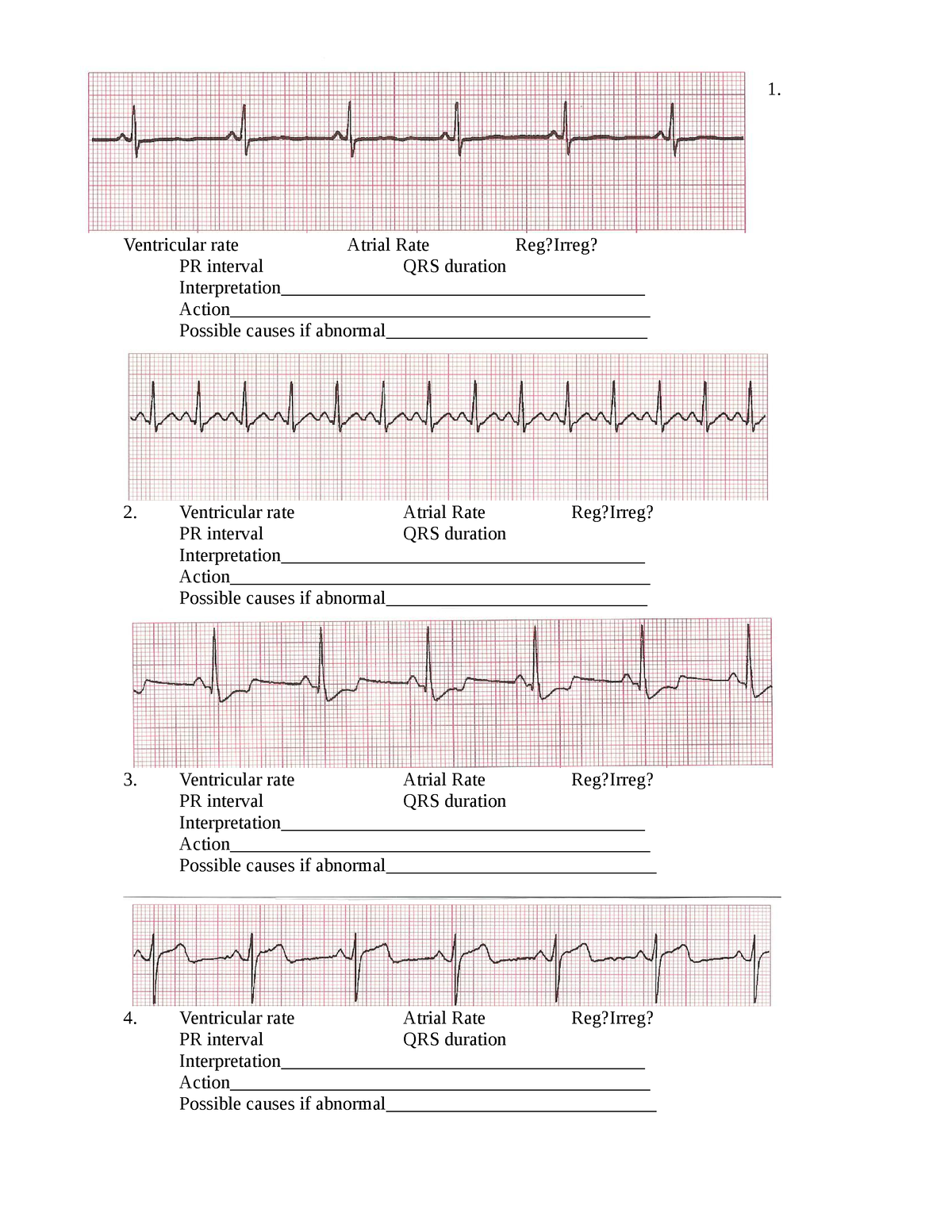 Sinus rhymsatrifibfullterstrips - 1. Ventricular rate Atrial Rate Reg ...