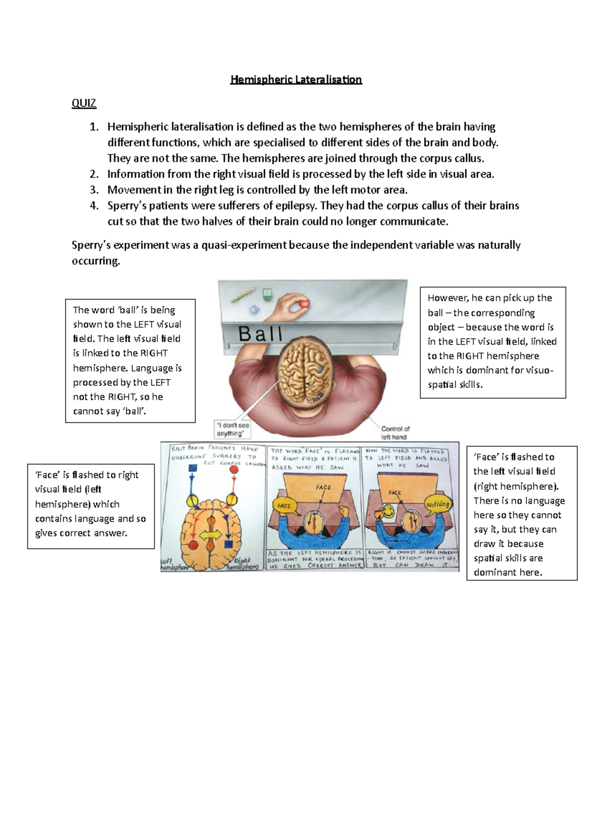 Hemispheric Lateralisation A03 Hemispheric Lateralisation QUIZ 1