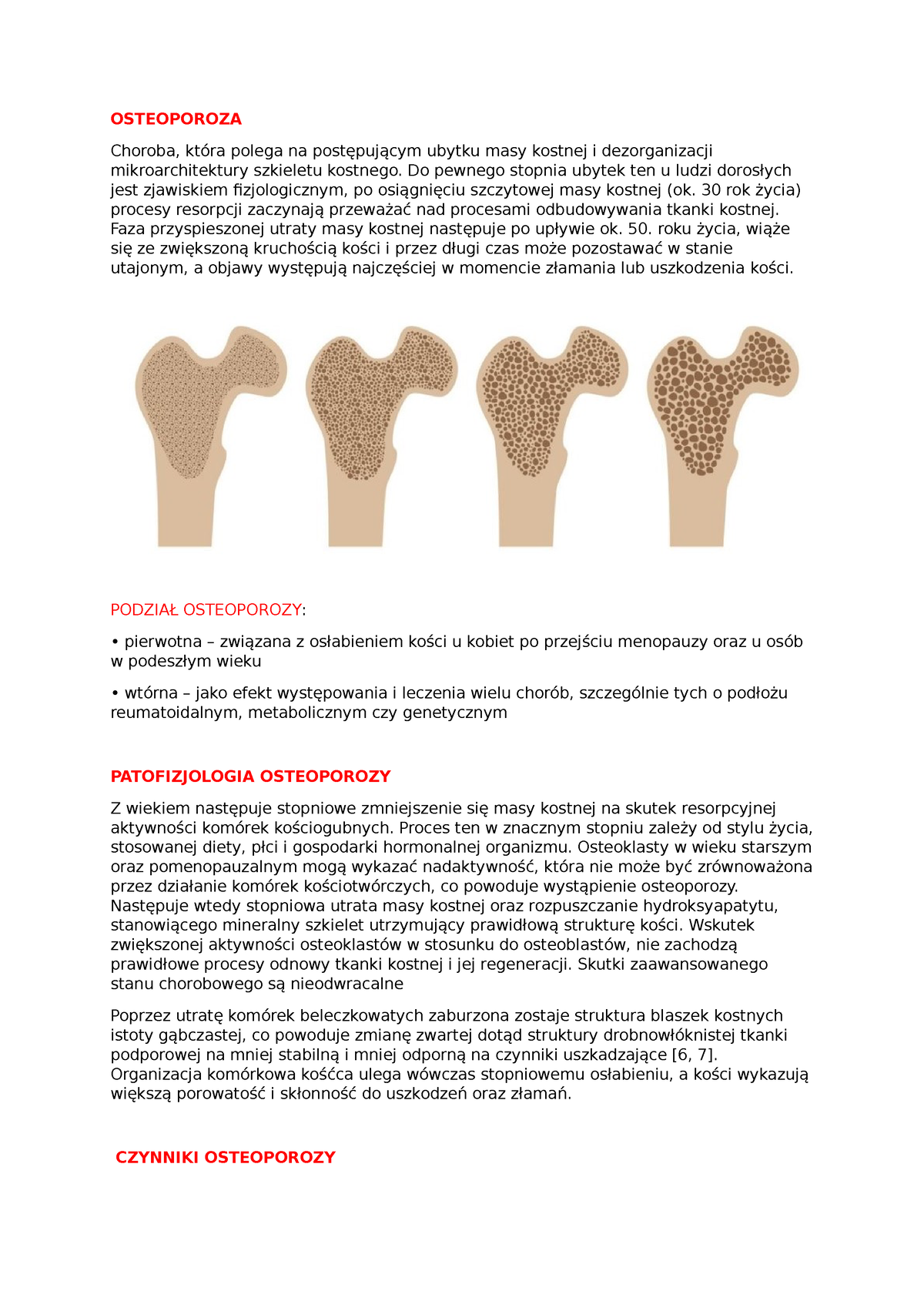Osteoporoza Osteoporoza Choroba Kt Ra Polega Na Post Puj Cym Ubytku