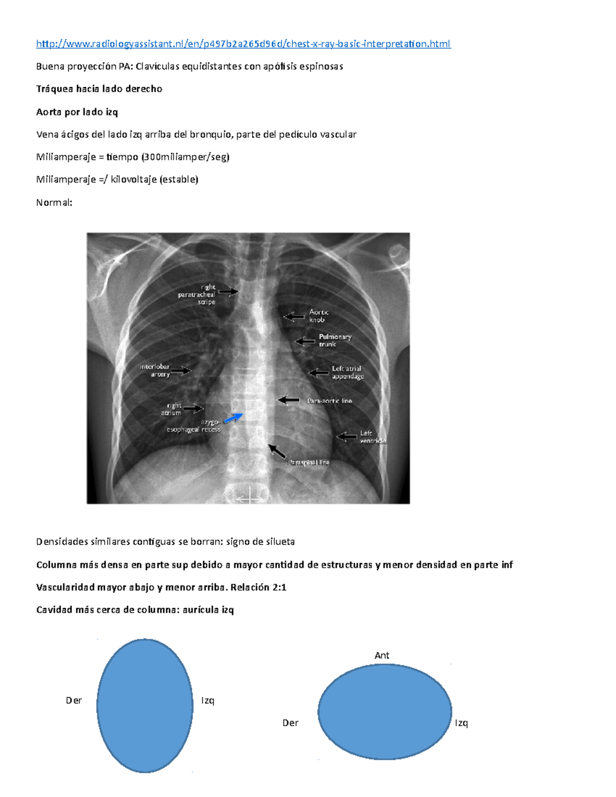 Tórax . radiologyassistant/en/p497b2a265d96d/chestxraybasic