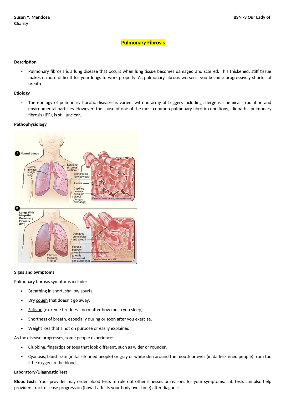 Activity 4 - medsurg - Susan Y. Mendoza BSN -3 Our Lady of Charity ...