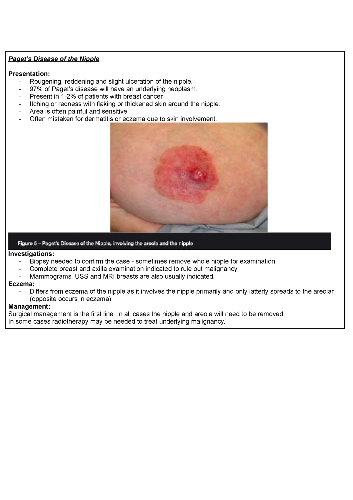 Paget S Disease Of The Nipple Pagets Disease Of The Nipple Presentation Rougening