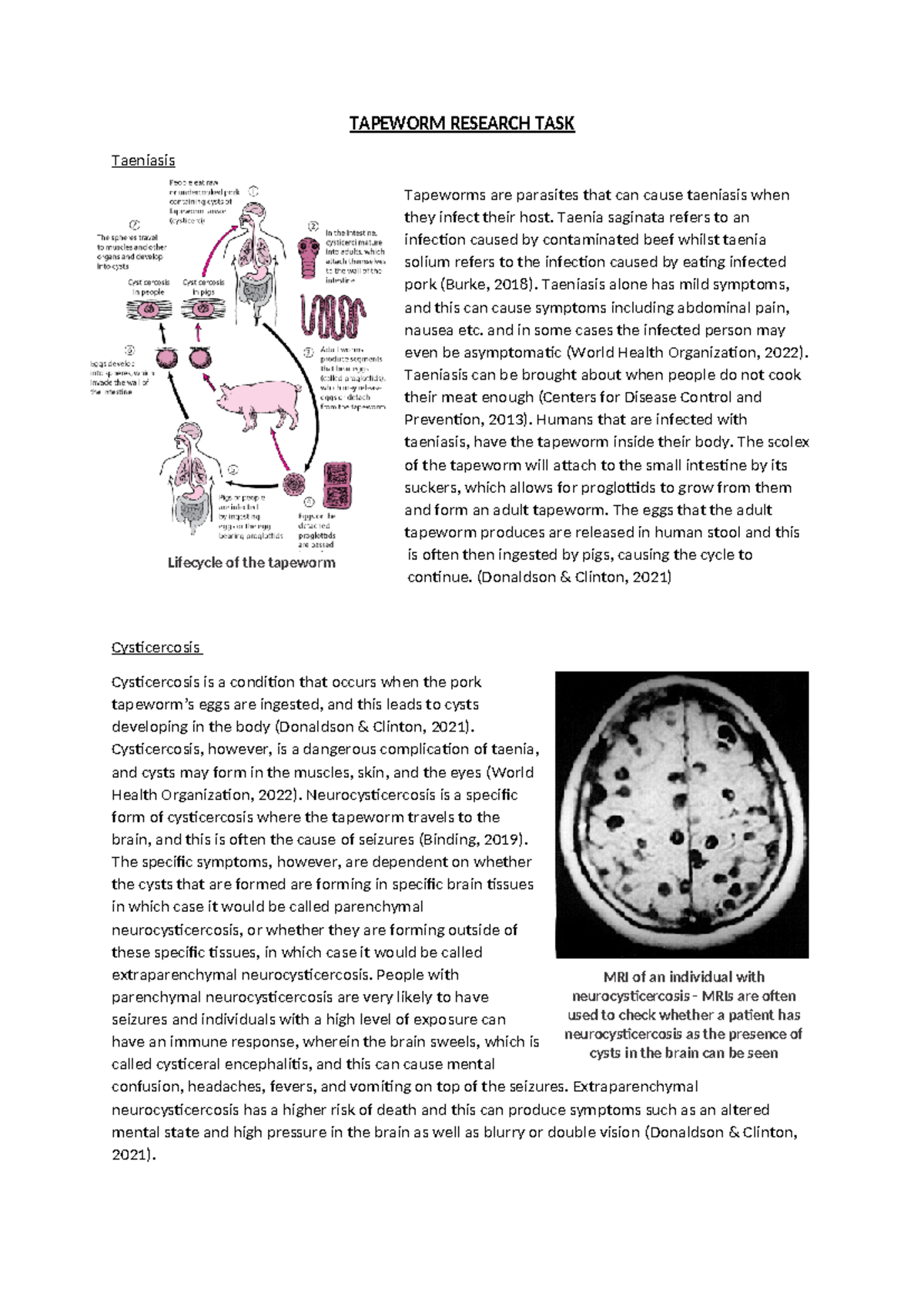Tapeworm Research Task - TAPEWORM RESEARCH TASK Taeniasis Tapeworms are ...