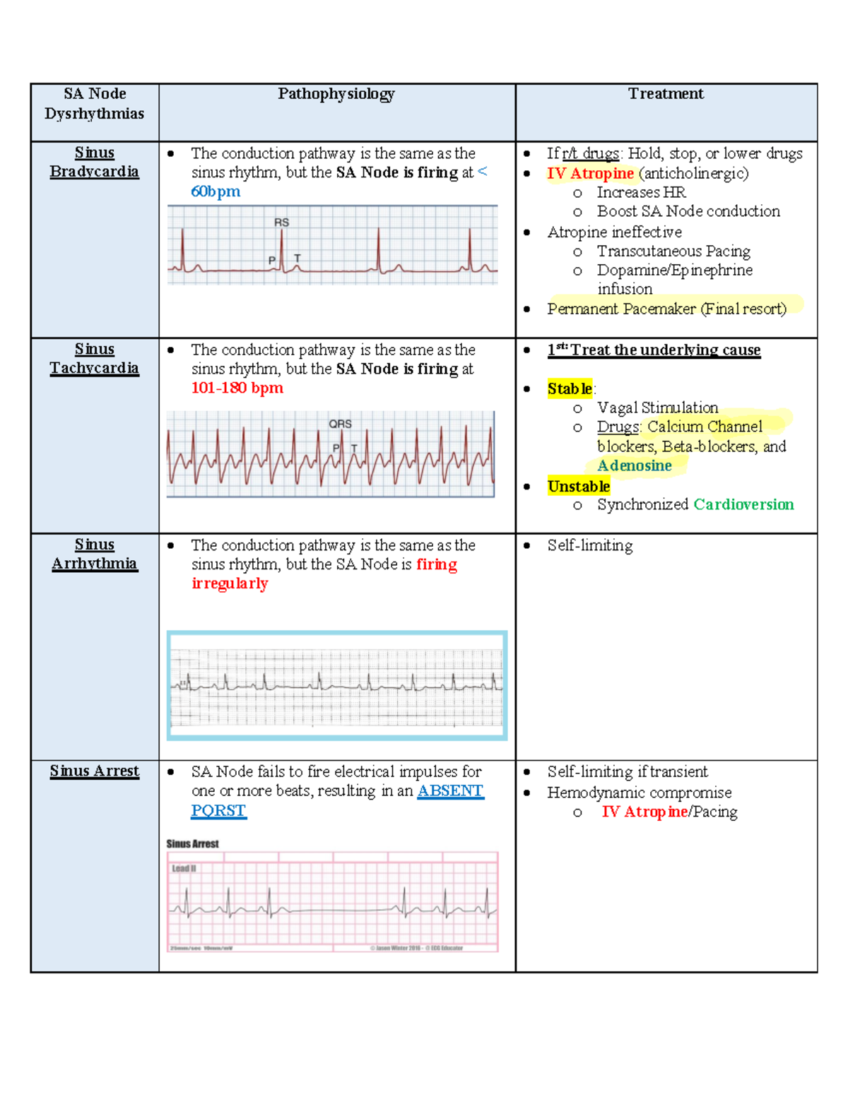 Dysrhythmias - notes - SA Node Dysrhythmias Pathophysiology Treatment ...