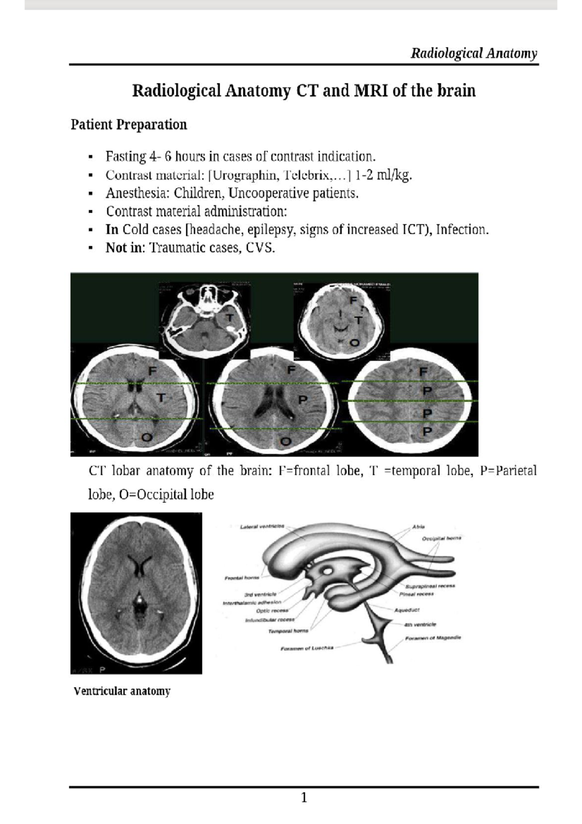 Ct, mri brain - central nervous system - Studocu