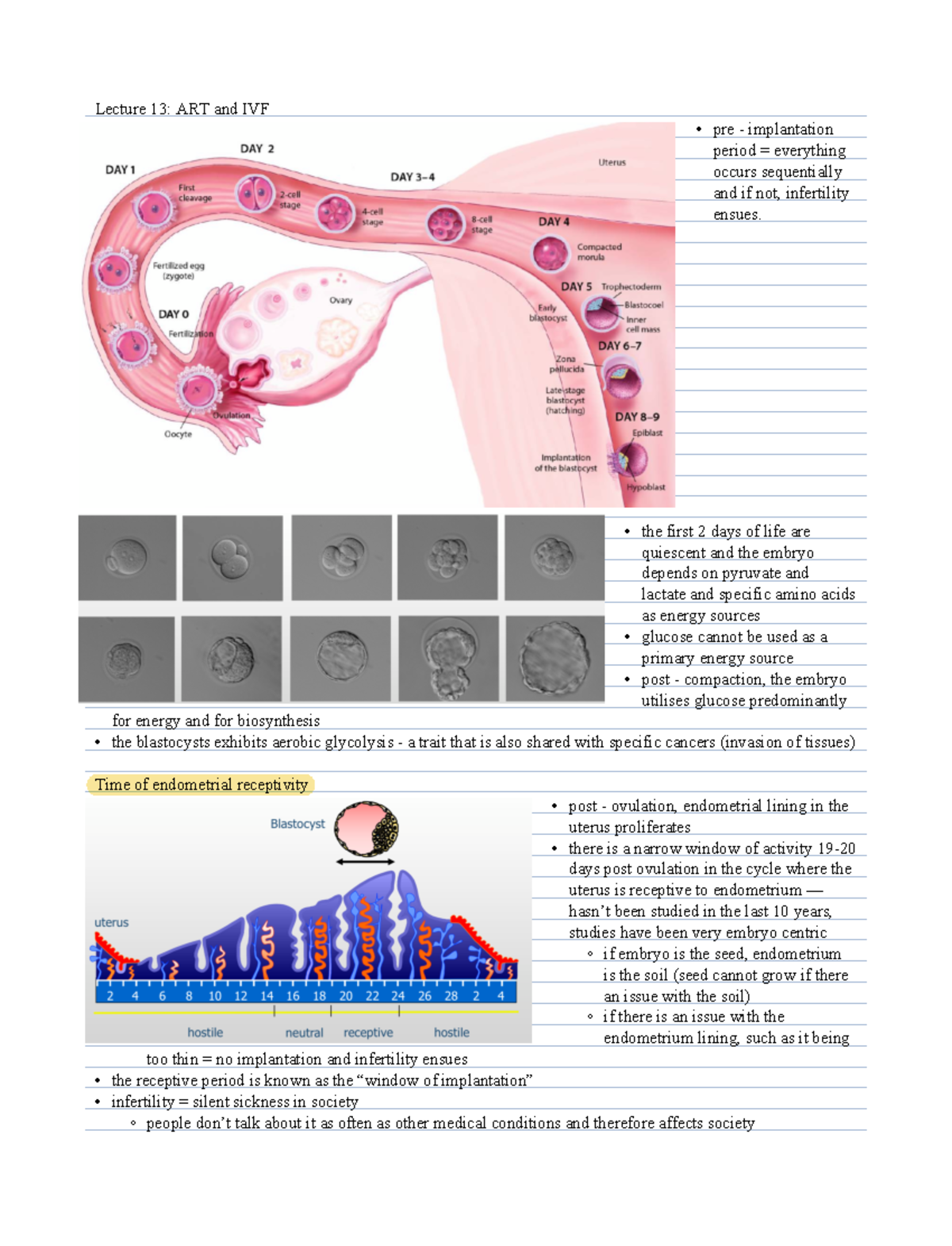 Lecture 13 ART and IVF - Lecture 13: ART and IVF - pre - implantation ...