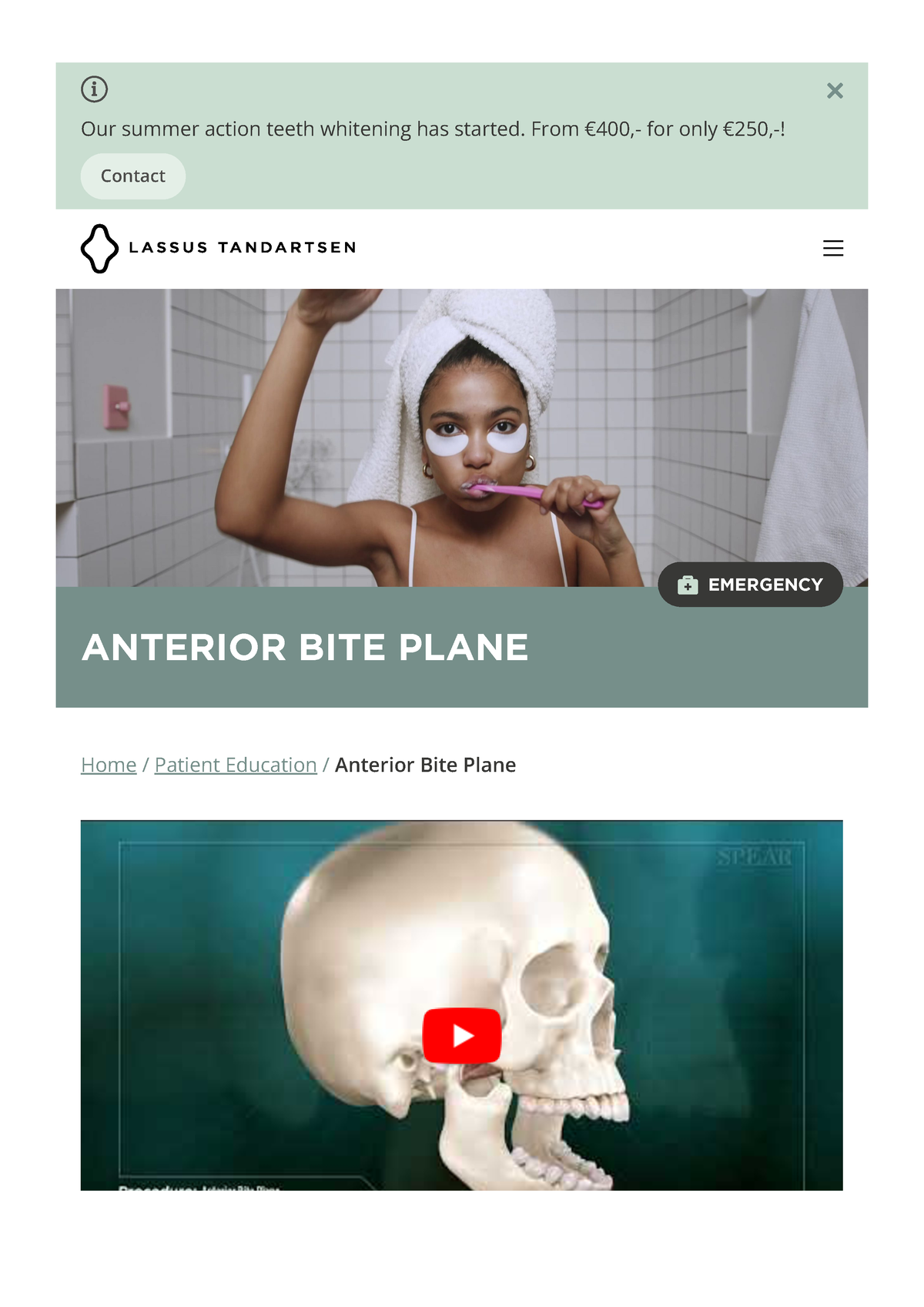 anterior-bite-plane-all-cities-our-summer-action-teeth-whitening