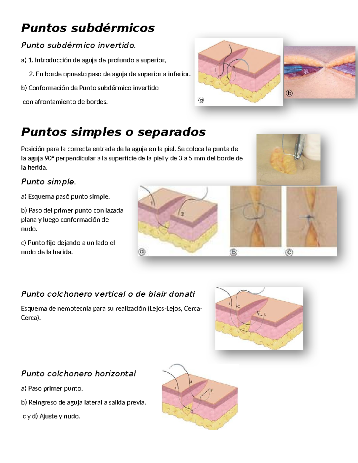 Puntos DE Sutura - Puntos subdérmicos Punto subdérmico invertido. a) 1 ...