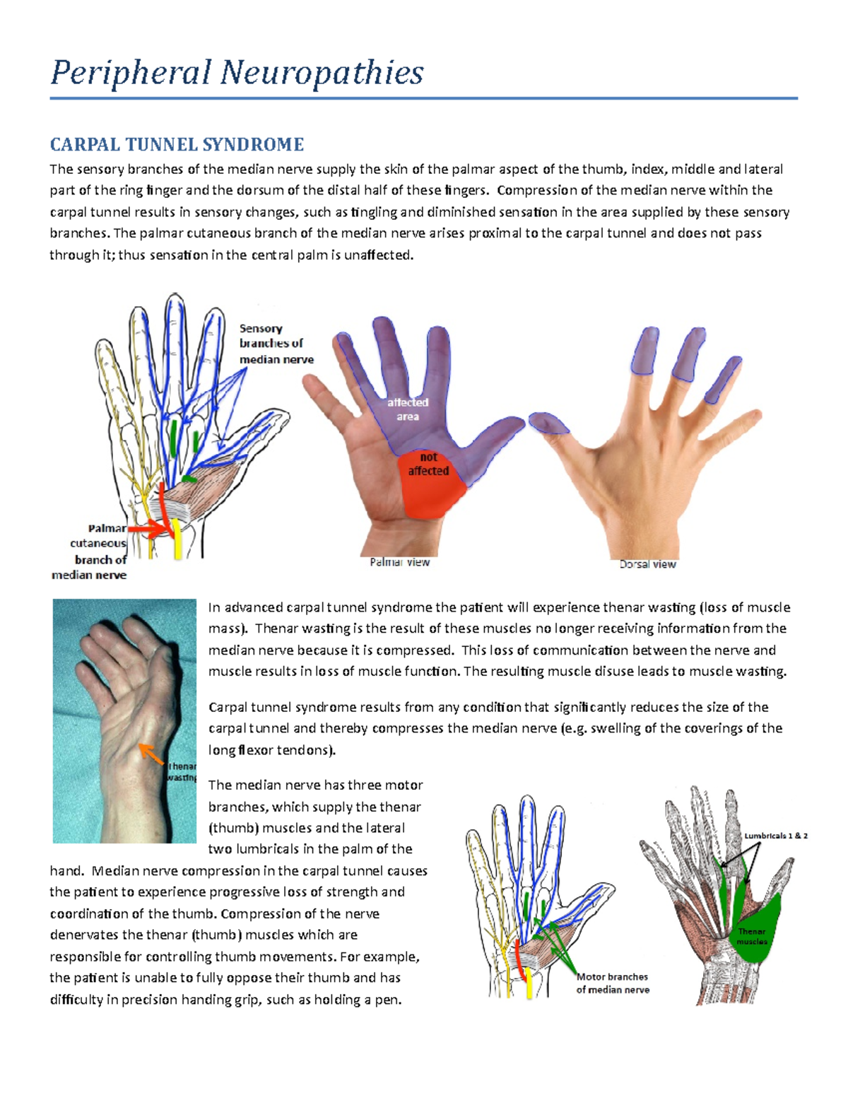 Peripheral Neuropathies Handout Word - Peripheral Neuropathies CARPAL ...