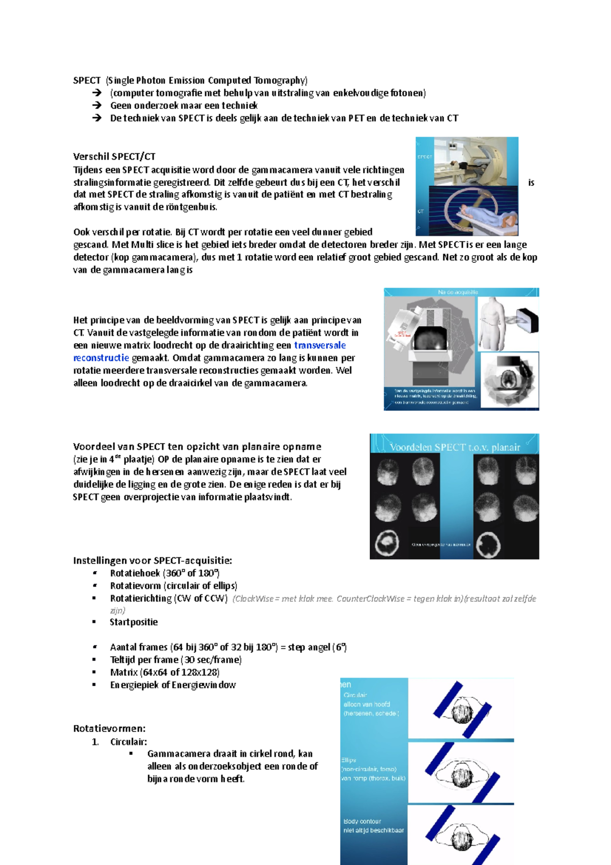 Spect - SPECT (Single Photon Emission Computed Tomography) (computer ...