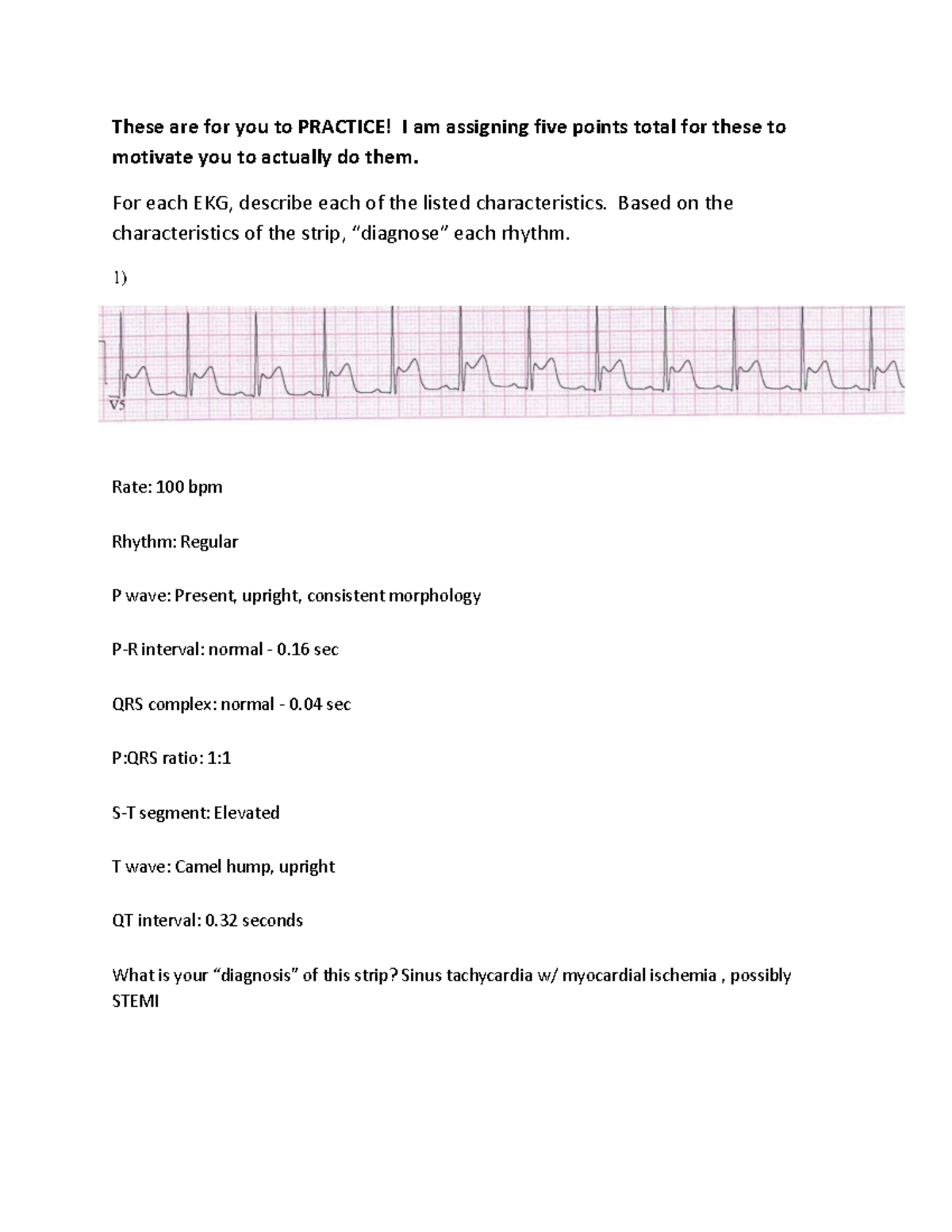 KIN 420 EKG Practice Problems S24 - These are for you to PRACTICE! I am ...