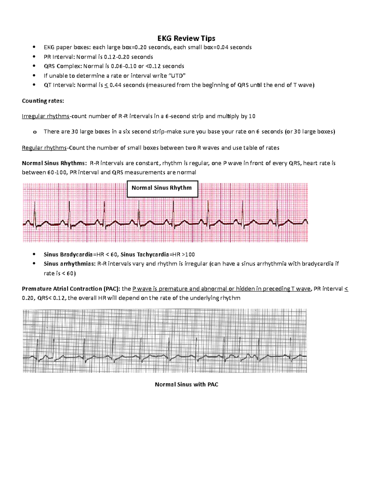 EKG Review Sheet EKG EKG Review Tips EKG paper boxes each large